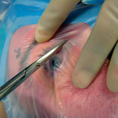 Chirurgical stérile jetable de mouleur ophtalmique de Formable drape avec le support de câble