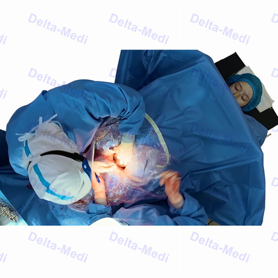 La section chirurgicale stérile de C drapent avec la gynécologie d'Obsterics de fenestration drapent le paquet