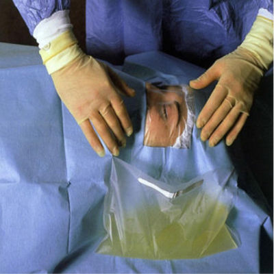 La feuille chirurgicale d'oeil de fenestration drapent avec le sac de collecte liquide intégré